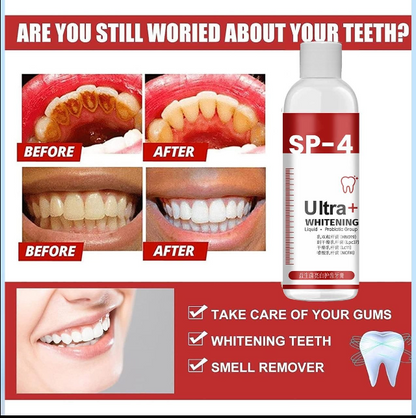 SP-4 Ultra+ Whitening Teeth (Pack of 1)